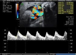 В пуповине расположены сосуды
