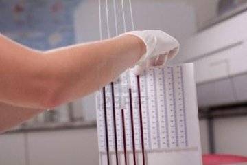 Синдром ускоренного соэ причины