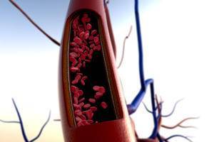 Недостаточность клапанов сердца