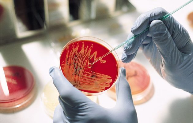 Пониженная средняя концентрация гемоглобина в эритроцитах