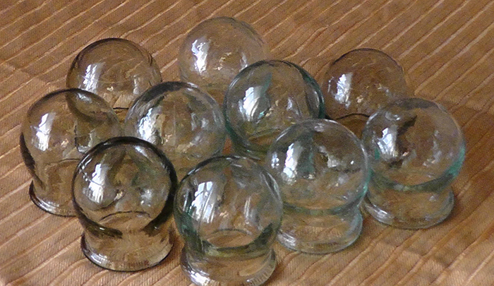 Банки медицинские