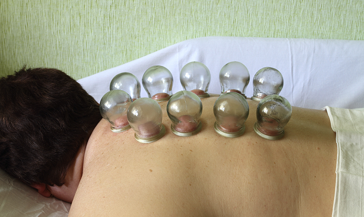 Банки на спину