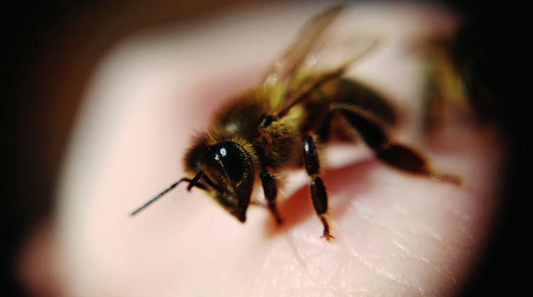 Укус пчелы