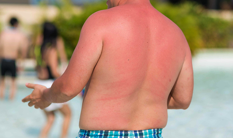 Человек загарает на пляже