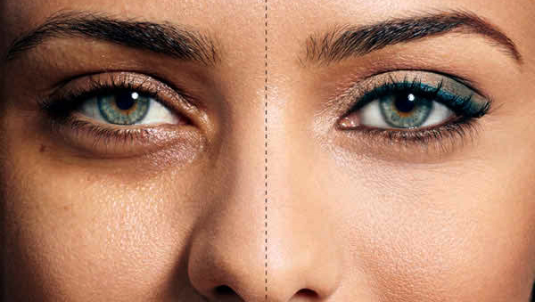 Кожа до и после