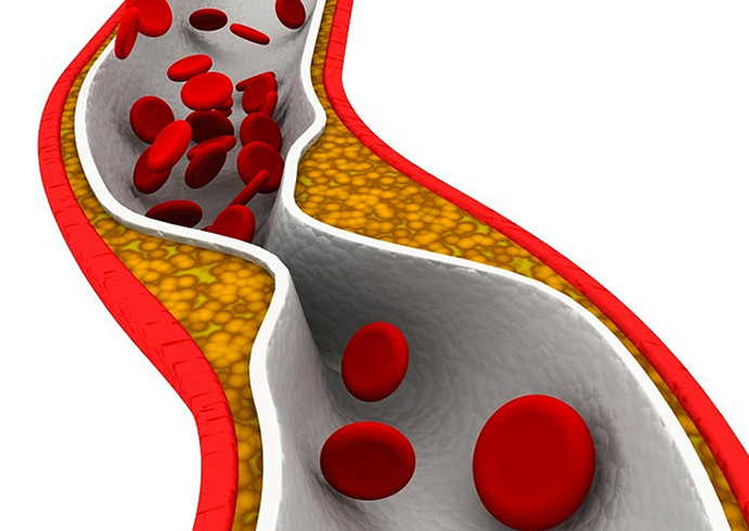 Влияние холестерина