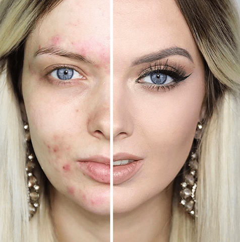 До и после использования серного мыла