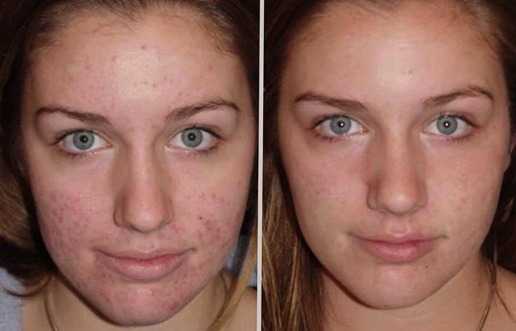 Лицо до и после мыла