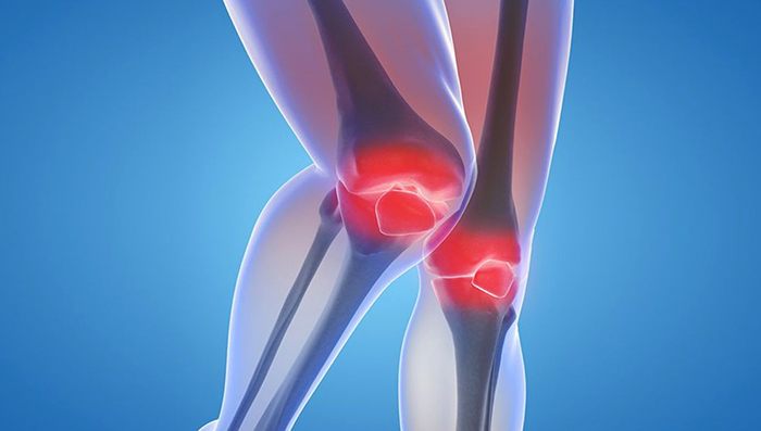 Колени при ожирении