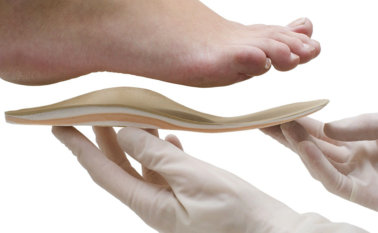 Подбор стельки