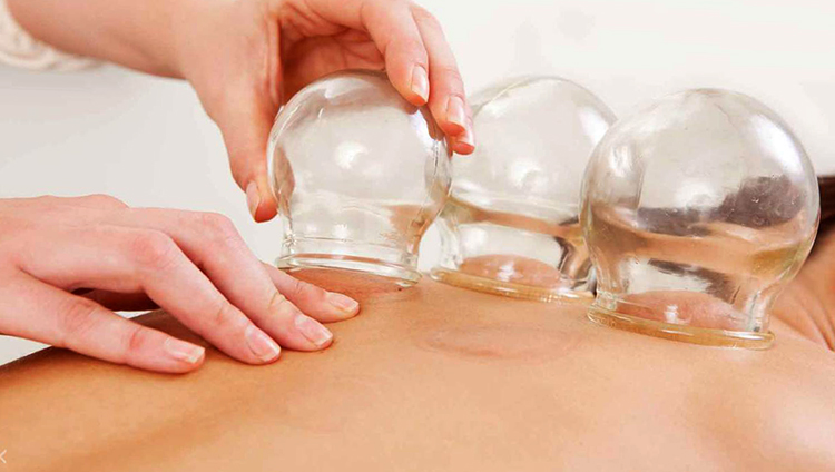 Установка банок