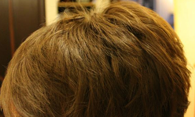 Волосы после дегтярного мыла