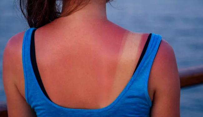 Загар у девушки