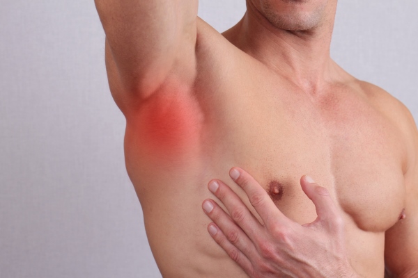 Боль в подмышечной впадине