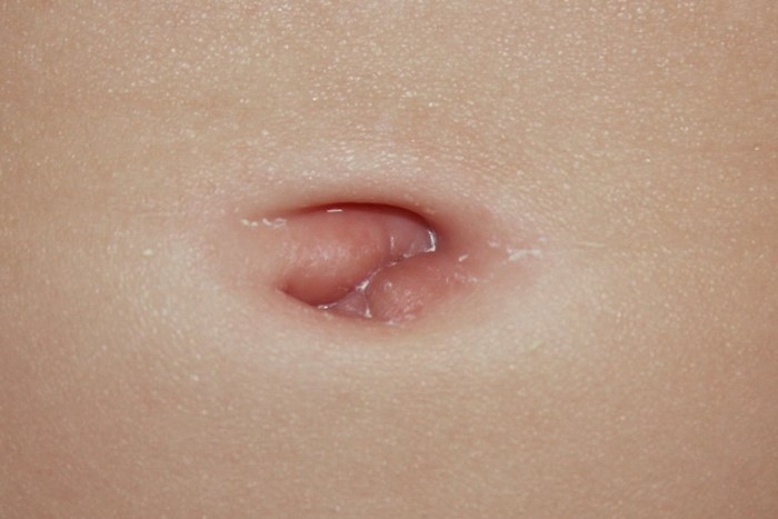 Влажный пупок